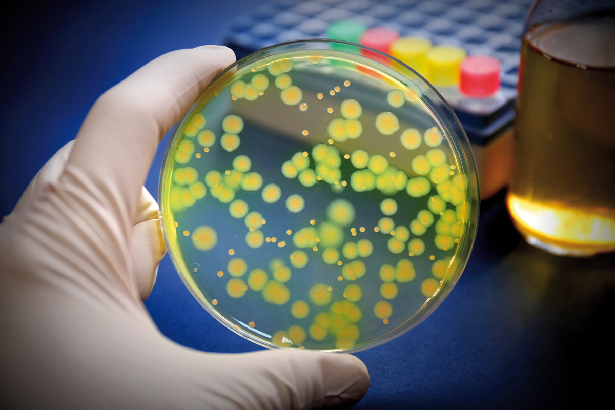 Pseudomonas aeruginosa en el agua ""